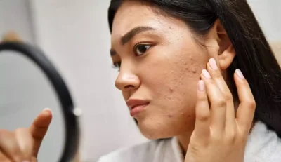 side effect of hormonal imbalance