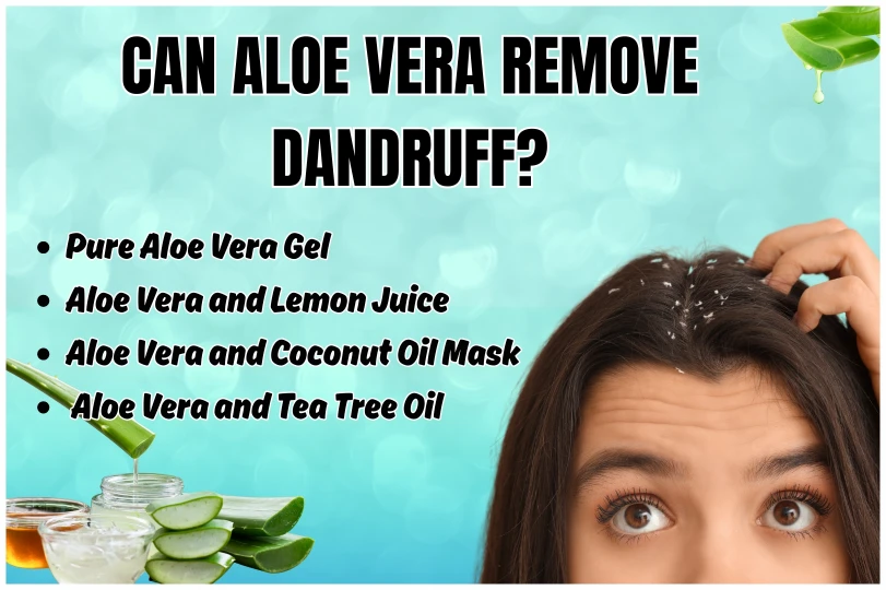 can aloe vera remove dandruff