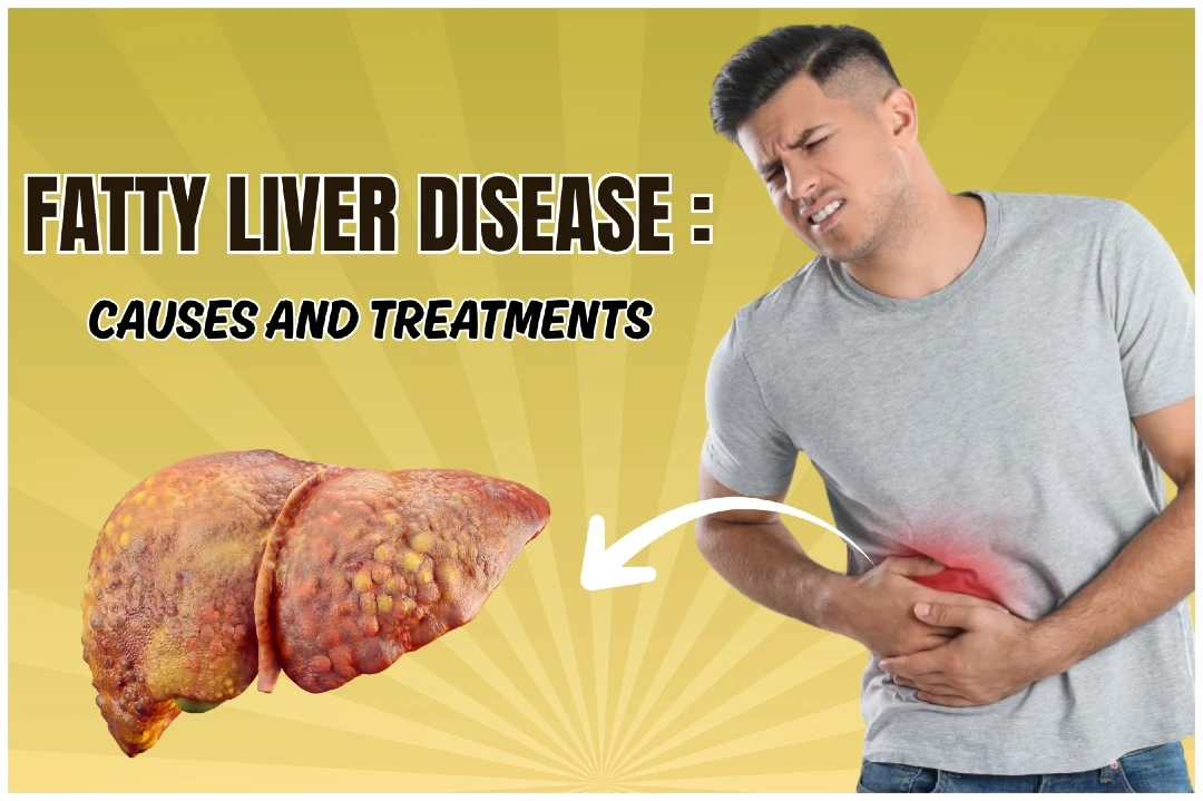 fatty liver disease, causues and ayurvedic treatment