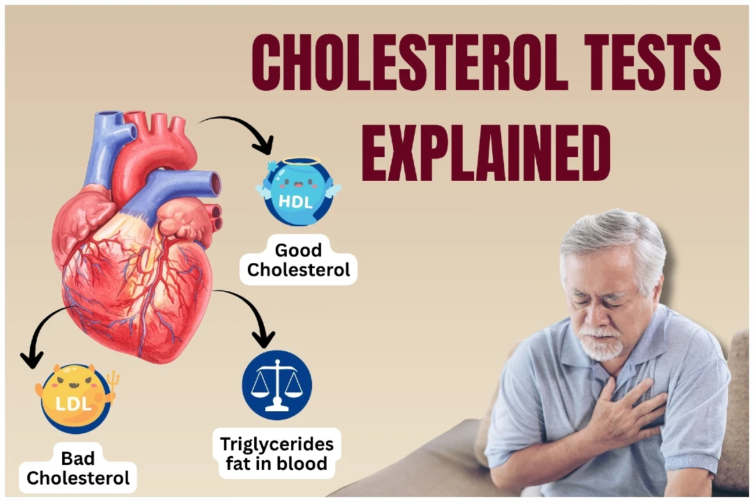 Cholesterol Tests Explained: Learn LDL, HDL, Triglycerides Ratios
